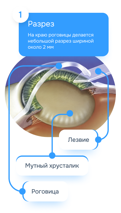 Разрез 1